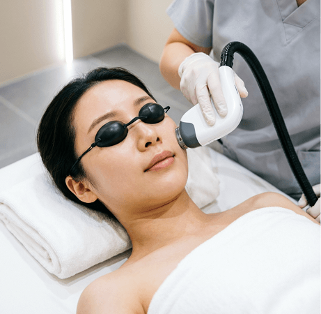 IPL Photofacial