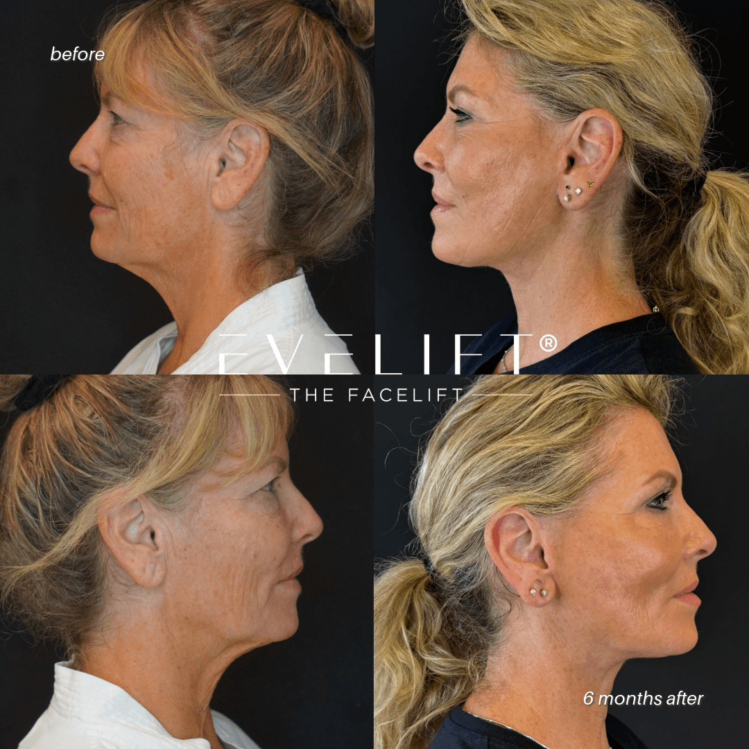 Glea Dirkse-2-RIGHT (UP) & LEFT (DOWN) (1)