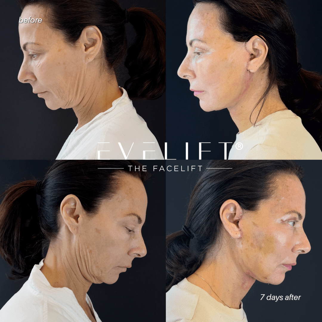 RoseAnn Sgarlato-91-RIGHT & LEFT DOWN (1)